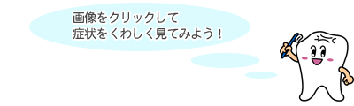 画像をクリックして症状を詳しく見てみよう！